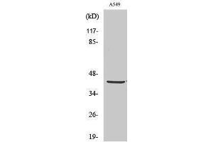 Western Blotting (WB) image for anti-Pyruvate Dehydrogenase (Lipoamide) alpha 1 (PDHA1) (C-Term) antibody (ABIN3186372) (PDHA1 antibody  (C-Term))