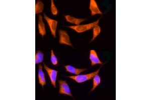 Immunofluorescence analysis of HeLa cells using ROCK2 Rabbit pAb (ABIN6129455, ABIN6147068, ABIN6147069 and ABIN6221359) at dilution of 1:150 (40x lens).