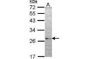 WB Image Sample (30 ug of whole cell lysate) A: Hela 12% SDS PAGE NME5 antibody antibody diluted at 1:1000 (NME5 antibody  (Center))