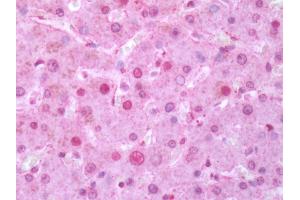 Human Liver: Formalin-Fixed, Paraffin-Embedded (FFPE) (RORC antibody  (Ligand Binding Domain))