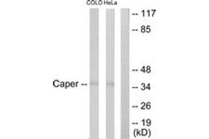 Western blot analysis of extracts from COLO205/HeLa cells, using Caper Antibody. (RBM39 antibody  (AA 171-220))