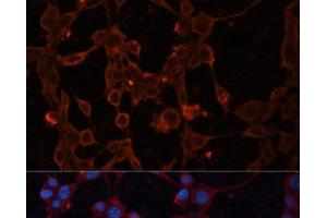 Immunofluorescence analysis of NIH/3T3 cells using SLC25A27 Polyclonal Antibody at dilution of 1:100. (SLC25A27 antibody)
