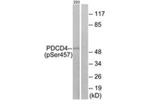 Western blot analysis of extracts from 293 cells treated with serum 20% 15', using PDCD4 (Phospho-Ser457) Antibody. (PDCD4 antibody  (pSer457))