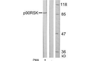 Image no. 1 for anti-Ribosomal Protein S6 Kinase, 90kDa, Polypeptide 1 (RPS6KA1) (Ser352) antibody (ABIN197330) (RPS6KA1 antibody  (Ser352))