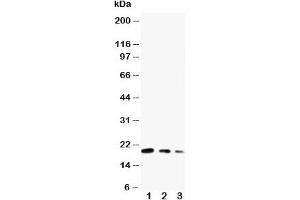 Western blot testing of CDC42 antibody and Lane 1:  ecombinant human protein 10ng;  2: 5ng;  3: 2.