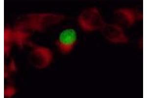 Immunofluorescence (IF) image for anti-Herpes Simplex Virus Type 1 ICP4 (HSV1 ICP4) antibody (ABIN265556)