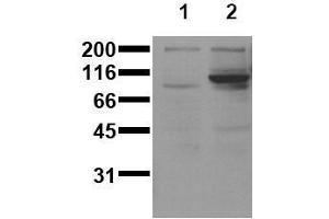 Western Blotting (WB) image for anti-Signal Transducer and Activator of Transcription 6, Interleukin-4 Induced (STAT6) (pTyr641) antibody (ABIN126901)