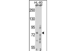Western blot analysis of RNF40 Antibody Pab pre-incubated without(lane 1) and with(lane 2) blocking peptide in HL-60 cell line lysate. (RNF40 antibody  (C-Term))