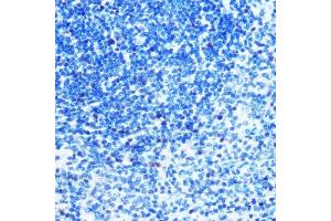 Immunohistochemistry of paraffin-embedded rat spleen using MCM3 Rabbit mAb (ABIN7268540) at dilution of 1:100 (40x lens). (MCM3 antibody)