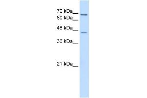 ALDH3A2 antibody used at 0. (ALDH3A2 antibody  (C-Term))