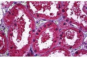 Human Kidney, Tubules: Formalin-Fixed, Paraffin-Embedded (FFPE) (Osteopontin antibody)