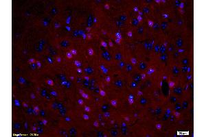 Formalin-fixed and paraffin embedded: rat brain tissue labeled with Anti-MBP Polyclonal Antibody (ABIN739400), Unconjugated at 1:200, followed by conjugation to the secondary antibody was Goat Anti-Rabbit IgG, PE conjugated at 1:200 for 40 minutes at 37°C DAPI(5 µg/ml, blue) was used to stain the cell nuclei (MBP antibody  (AA 69-85))