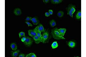 Immunofluorescent analysis of MCF-7 cells using ABIN7158190 at dilution of 1:100 and Alexa Fluor 488-congugated AffiniPure Goat Anti-Rabbit IgG(H+L) (LRRC4C antibody  (AA 201-500))