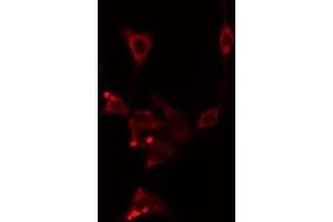 ABIN6277142 staining  Hela cells by IF/ICC. (CYP2E1 antibody  (Internal Region))
