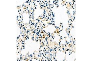 Immunohistochemistry of paraffin embedded rat lung using TMEM176A (ABIN7075995) at dilution of 1:500 (400x lens) (TMEM176A antibody)