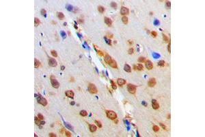 Immunohistochemical analysis of MC4 Receptor staining in human brain formalin fixed paraffin embedded tissue section. (MC4R antibody  (C-Term))