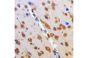 Immunohistochemical analysis of MC4 Receptor staining in human brain formalin fixed paraffin embedded tissue section.