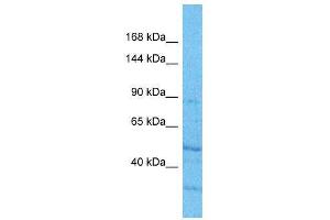 Host:  Rabbit  Target Name:  GRM6  Sample Type:  HepG2 Whole Cell lysates  Antibody Dilution:  1. (Metabotropic Glutamate Receptor 6 antibody  (C-Term))