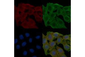 ABIN6258013 and ABIN6274979 staining Hela cells(24h of starvation treatment) by IF/ICC. (CDC42EP2 antibody  (N-Term))