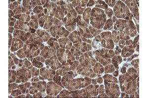 Image no. 1 for anti-Phosphoinositide-3-Kinase, Regulatory Subunit 5 (PIK3R5) antibody (ABIN1500211) (PIK3R5 antibody)