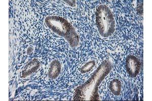 Image no. 2 for anti-Pyridoxal Kinase (PDXK) antibody (ABIN1500145) (PDXK antibody)