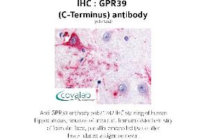 Image no. 1 for anti-G Protein-Coupled Receptor 39 (GPR39) (C-Term) antibody (ABIN1735081) (GPR39 antibody  (C-Term))