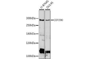 Western blot analysis of extracts of various cell lines, using CEP290 antibody (ABIN7266277) at 1:1000 dilution. (CEP290 antibody  (AA 950-1050))