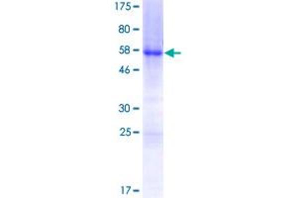 HOXB5 Protein (AA 1-269) (GST tag)