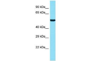 Host: Rabbit Target Name: ANKRD34B Sample Type: 721_B Whole Cell lysates Antibody Dilution: 1. (ANKRD34B antibody  (N-Term))