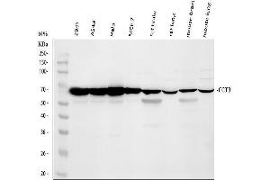 anti-Chaperonin Containing TCP1, Subunit 3 (Gamma) (CCT3) (AA 497-536), (C-Term) antibody
