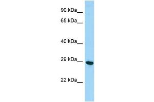 Host:  Rabbit  Target Name:  Phf7  Sample Type:  Mouse Testis lysates  Antibody Dilution:  1. (PHF7 antibody  (C-Term))