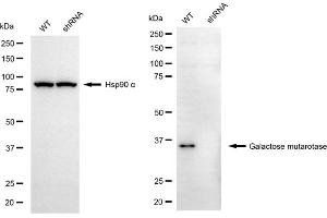 Western blotting analysis using galactose mutarotase antibody (ABIN7798681).