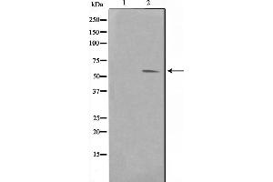 Western blot analysis on HuvEc cell lysate using Pim-1 Antibody，The lane on the left is treated with the antigen-specific peptide. (PIM1 antibody  (Internal Region))