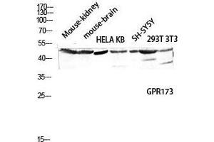 Western Blot (WB) analysis of Mouse Kidney Mouse Brain HeLa KB SH-SY5Y 293T 3T3 lysis using GPR173 antibody. (GPR173 antibody  (Internal Region))