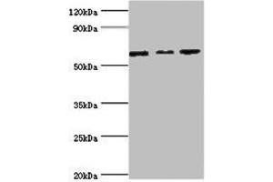 Western blot All lanes: MAPK4 ntibody at 6 μg/mL Lane 1: Mouse brain tissue Lane 2: 293T whole cell lysate Lane 3: Jurkat whole cell lysate Secondary Goat polyclonal to rabbit IgG at 1/10000 dilution Predicted band size: 66 kDa Observed band size: 66 kDa (MAPK4 antibody  (AA 348-587))