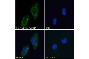 ABIN190858 Immunofluorescence analysis of paraformaldehyde fixed U251 cells, permeabilized with 0. (TMED10 antibody  (C-Term))