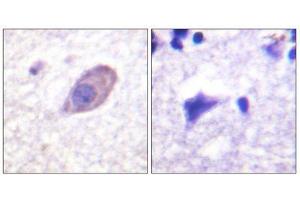 Immunohistochemistry (IHC) image for anti-Potassium Inwardly-Rectifying Channel, Subfamily J, Member 16 (KCNJ16) (Ser416) antibody (ABIN1848056) (KIR5.1 antibody  (Ser416))