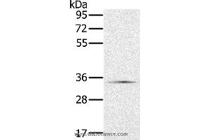 Western blot analysis of Hela cell, using NDUFA9 Polyclonal Antibody at dilution of 1:400 (NDUFA9 antibody)
