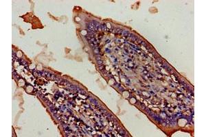 Immunohistochemistry of paraffin-embedded human small intestine tissue using ABIN7152499 at dilution of 1:100 (FBXW2 antibody  (AA 72-340))