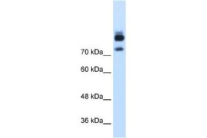 MTMR1 antibody used at 1. (MTMR1 antibody  (C-Term))