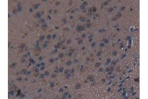 Detection of THBS1 in Mouse Brain Tissue using Polyclonal Antibody to Thrombospondin 1 (THBS1) (Thrombospondin 1 antibody  (AA 61-259))