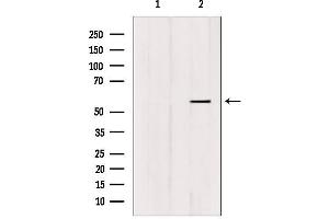 Western blot analysis of extracts from HUVEC, using FOXC1/2 Antibody. (FOXC1 antibody)