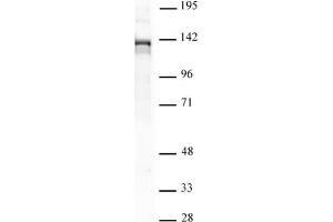 PHF8 pAb tested by Western blot.