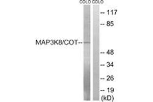 Western blot analysis of extracts from COLO205 cells, treated with Insulin 0. (MAP3K8 antibody  (AA 366-415))