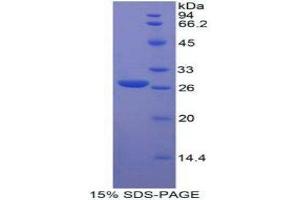 SDS-PAGE (SDS) image for Fibroblast Growth Factor Receptor-Like 1 (FGFRL1) (AA 168-378) protein (His tag) (ABIN1878475)