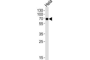 Western Blotting (WB) image for anti-Kinesin Light Chain 1 (KLC1) antibody (ABIN3003845) (KLC1 antibody)