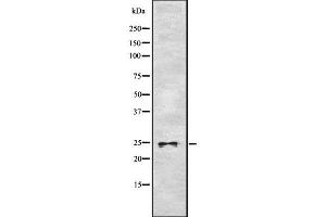 Western blot analysis of ASCL1 using RAW264. (ASCL1 antibody  (C-Term))