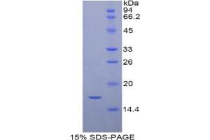 SDS-PAGE analysis of Pig RBP7 Protein. (RBP7 Protein)