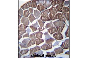 NPHP3 Antibody (N-term) (ABIN656679 and ABIN2845918) immunohistochemistry analysis in formalin fixed and paraffin embedded human skeletal muscle followed by peroxidase conjugation of the secondary antibody and DAB staining. (NPHP3 antibody  (N-Term))