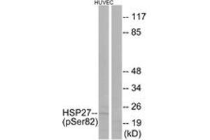 Western blot analysis of extracts from HuvEc cells treated with TNF 20ng/ml 30', using HSP27 (Phospho-Ser82) Antibody. (HSP27 antibody  (pSer82))